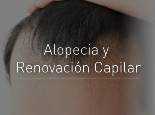 Alopecia y Renovación Capilar